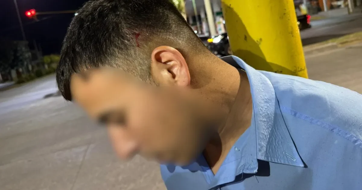 Chofer herido en La Plata: ataque a un micro genera preocupación entre pasajeros