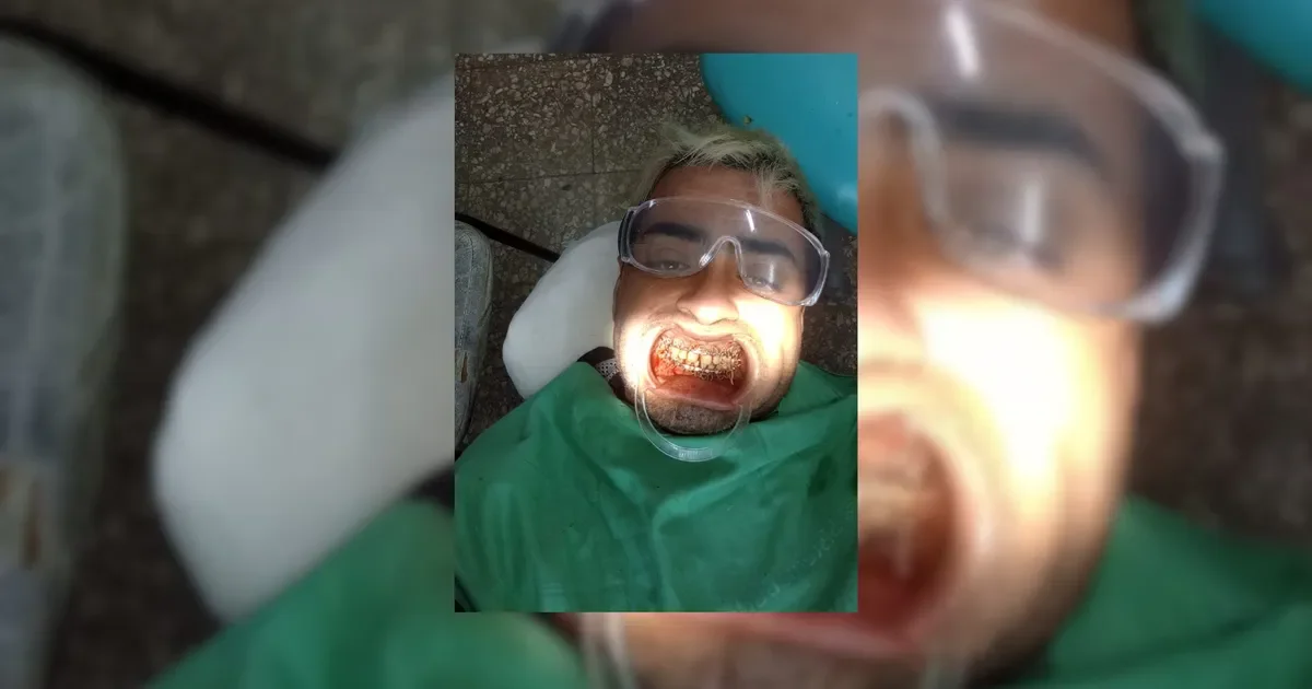 Confusión en La Plata: joven agredido al regresar de jugar al fútbol