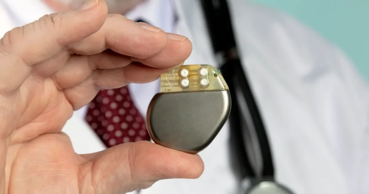 Investigadores de la UNLP y el Hospital Rossi avanzan en el desarrollo de un innovador marcapasos