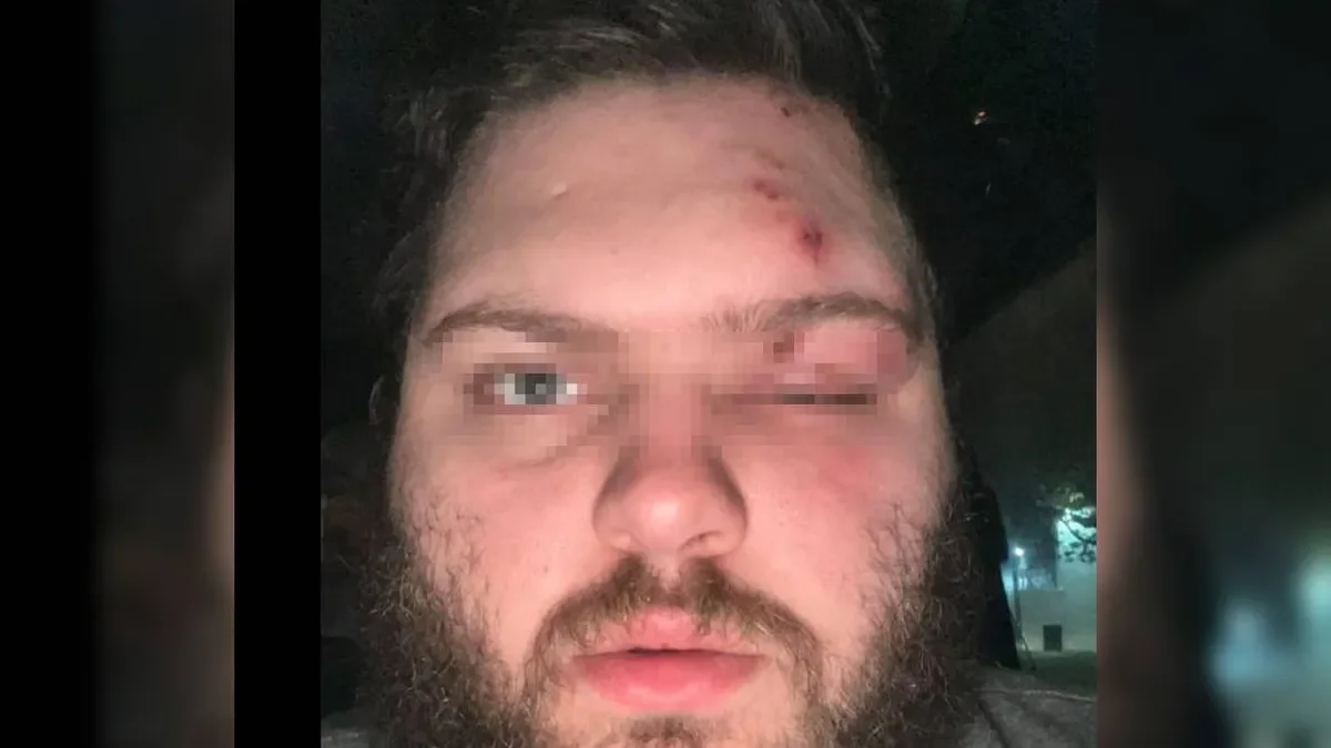 La Plata: un accidente en la quema de muñecos deja a un hombre con un ojo perdido