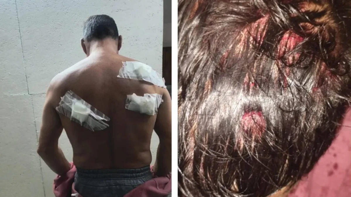 Tolosa conmocionada: un ataque a cuchillo pone en alerta a los vecinos